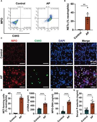 High expression of P-selectin induces neutrophil extracellular traps via the PSGL-1/Syk/Ca2+/PAD4 pathway to exacerbate acute pancreatitis